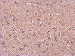 HSP90 beta Antibody in Immunohistochemistry (Paraffin) (IHC (P))