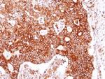 HSP90 beta Antibody in Immunohistochemistry (Paraffin) (IHC (P))