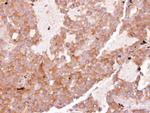 eIF3d Antibody in Immunohistochemistry (Paraffin) (IHC (P))