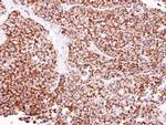 ALDH2 Antibody in Immunohistochemistry (Paraffin) (IHC (P))