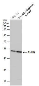 ALDH2 Antibody in Western Blot (WB)