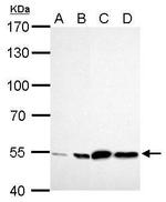 ALDH2 Antibody in Western Blot (WB)