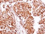 CK2 beta Antibody in Immunohistochemistry (Paraffin) (IHC (P))