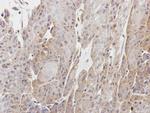 CPNE1 Antibody in Immunohistochemistry (Paraffin) (IHC (P))