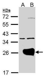 RAB1A Antibody in Western Blot (WB)