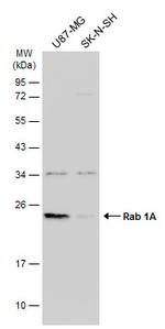 RAB1A Antibody in Western Blot (WB)