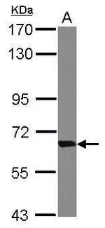 Transketolase Antibody in Western Blot (WB)