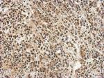 hnRNP A1 Antibody in Immunohistochemistry (Paraffin) (IHC (P))