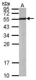 PABPN1 Antibody in Western Blot (WB)