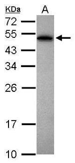 PABPN1 Antibody in Western Blot (WB)