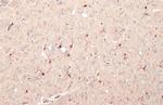 IBA1 Antibody in Immunohistochemistry (Paraffin) (IHC (P))