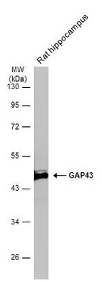 GAP43 Antibody in Western Blot (WB)