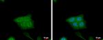 CRABP2 Antibody in Immunocytochemistry (ICC/IF)