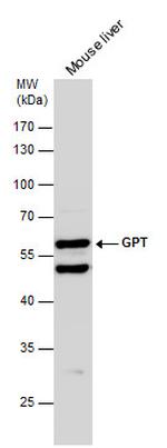 GPT Antibody in Western Blot (WB)