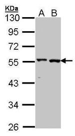 GPT Antibody in Western Blot (WB)