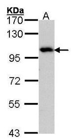 ADAM15 Antibody in Western Blot (WB)