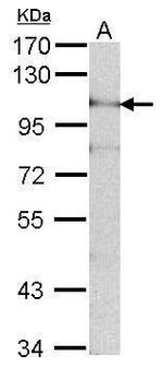 ADAM15 Antibody in Western Blot (WB)