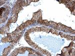 alpha Adducin Antibody in Immunohistochemistry (Paraffin) (IHC (P))