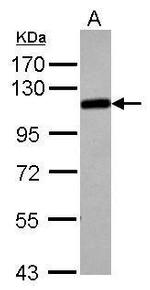 alpha Adducin Antibody in Western Blot (WB)