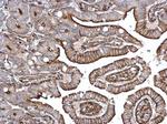 alpha Actinin 4 Antibody in Immunohistochemistry (Paraffin) (IHC (P))