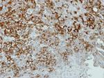 alpha Actinin 4 Antibody in Immunohistochemistry (Paraffin) (IHC (P))