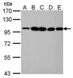 alpha Actinin 4 Antibody in Western Blot (WB)