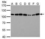 alpha Actinin 4 Antibody in Western Blot (WB)