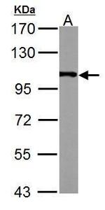 alpha Actinin 4 Antibody in Western Blot (WB)