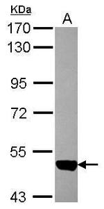 ACVRL1 Antibody in Western Blot (WB)