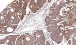 CDA Antibody in Immunohistochemistry (Paraffin) (IHC (P))