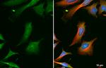 GRK2 Antibody in Immunocytochemistry (ICC/IF)