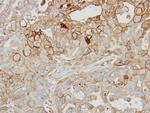 GRK2 Antibody in Immunohistochemistry (Paraffin) (IHC (P))