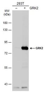 GRK2 Antibody in Western Blot (WB)