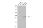 GRK2 Antibody in Western Blot (WB)