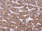 SDHA Antibody in Immunohistochemistry (Paraffin) (IHC (P))