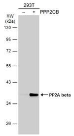 PP2A beta Antibody in Western Blot (WB)