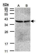 PP2A beta Antibody in Western Blot (WB)