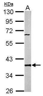 PP2A beta Antibody in Western Blot (WB)