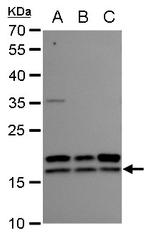 NME2 Antibody in Western Blot (WB)