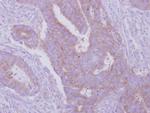 HGS Antibody in Immunohistochemistry (Paraffin) (IHC (P))