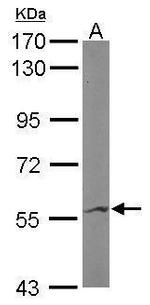 IMPDH2 Antibody in Western Blot (WB)