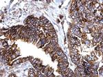 IFITM1 Antibody in Immunohistochemistry (Paraffin) (IHC (P))