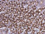 ATP5A1 Antibody in Immunohistochemistry (Paraffin) (IHC (P))