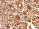 ATP5A1 Antibody in Immunohistochemistry (Paraffin) (IHC (P))