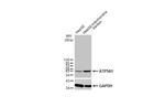 ATP5A1 Antibody in Western Blot (WB)