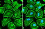 MYH9 Antibody in Immunocytochemistry (ICC/IF)