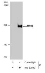 MYH9 Antibody in Immunoprecipitation (IP)