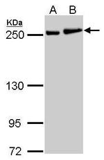 MYH9 Antibody in Western Blot (WB)