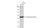 Creatine Kinase BB Antibody in Western Blot (WB)