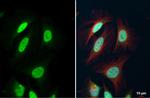 FEN1 Antibody in Immunocytochemistry (ICC/IF)